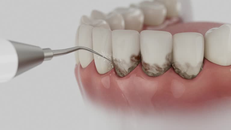 Trusted Dental Crowns And Bridges service in Howard City, MI - Dentist Open Now